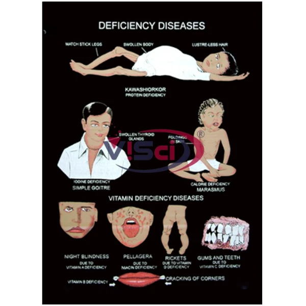 Deficiency Diseases