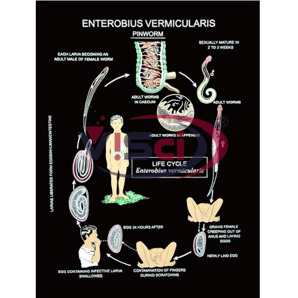 Enterobius vermicularis  (Pinworm)